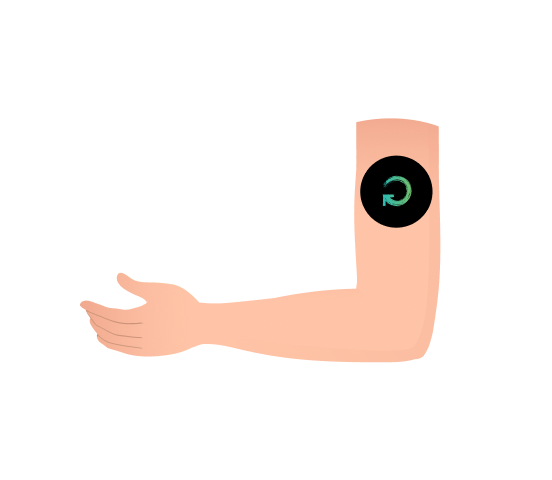 Diabetes reversal